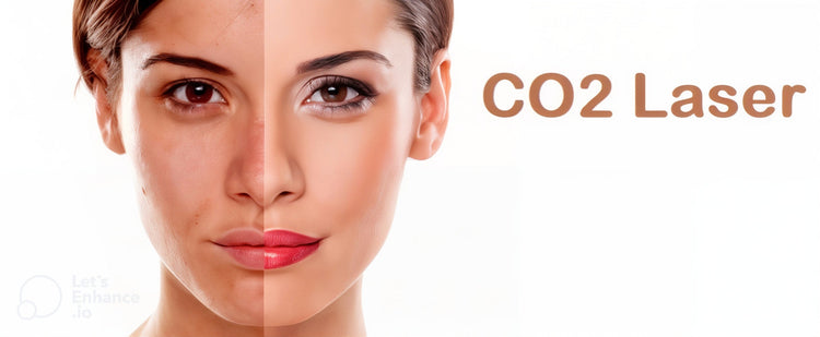 Lazer CO2/ Laser CO2