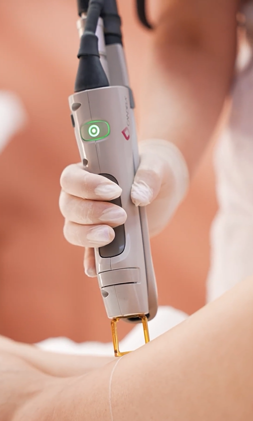 Lazer 'Total body' / Total body laser