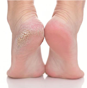 PEDIKYR KLASIK PER FEMRA + APLIKIM KALCIUM - FULL SPA FOOT TREATMENT FOR WOMAN [+ APPLYING CALCIUM ]
