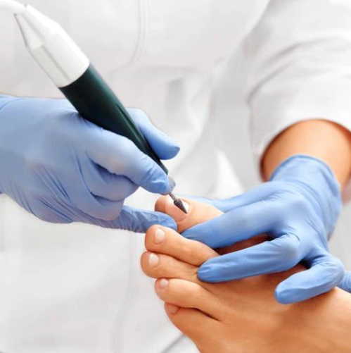 PASTRIMI I THONJVE TE KEMBES PER MESHKUJ - TOTAL CLEANING FOOT NAILS FOR MAN