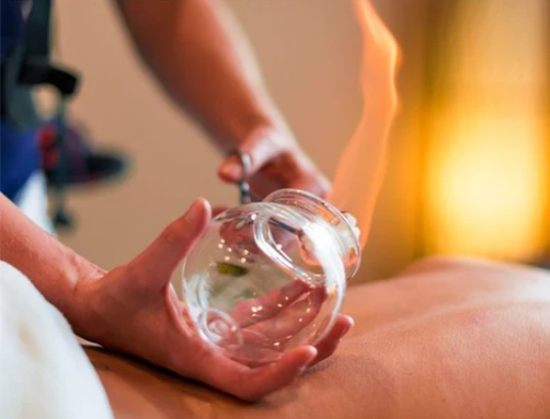 MASAZH ME KUPA - CUPPING MASSAGE